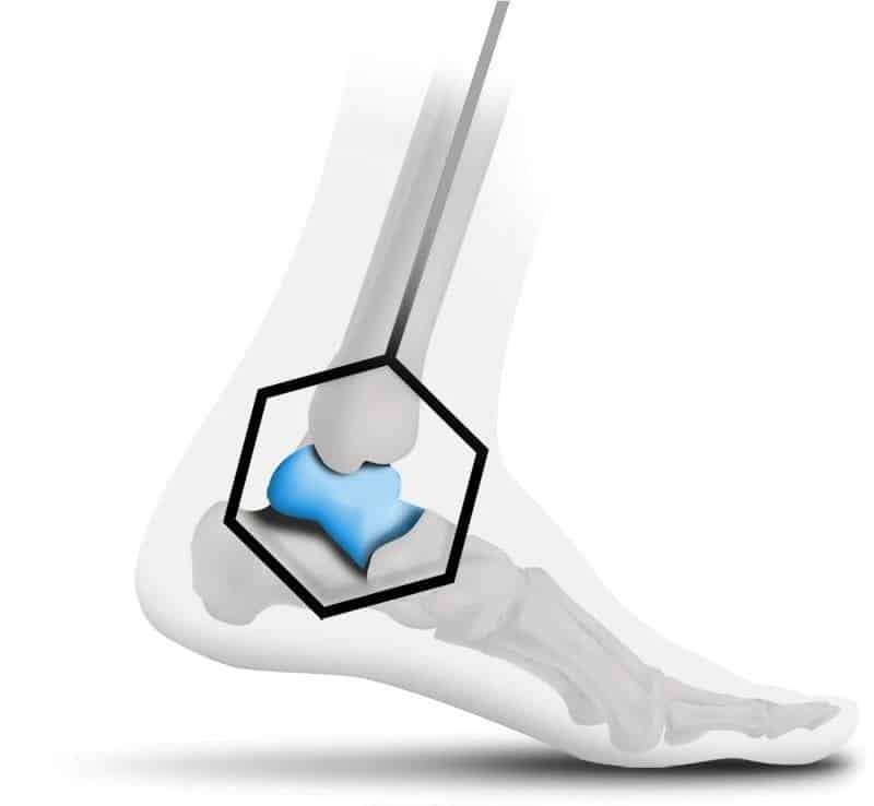 why foot